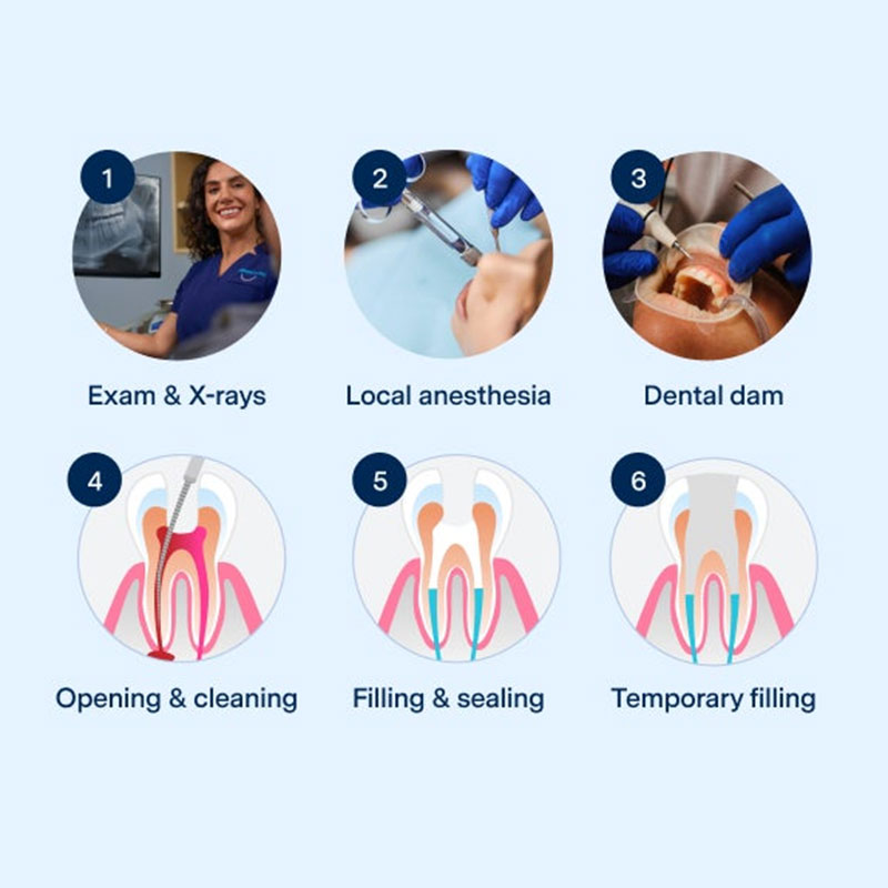 cavity filling in Jaipur
