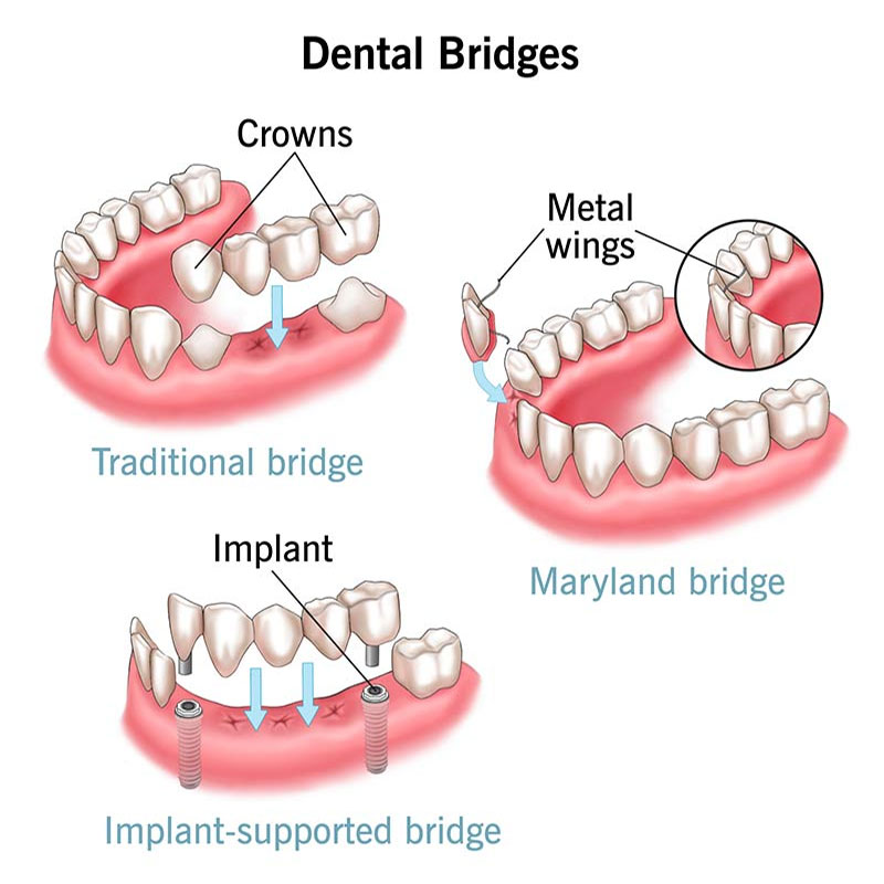 dentist in Jaipur