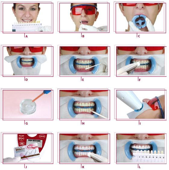 dentist in Jaipur