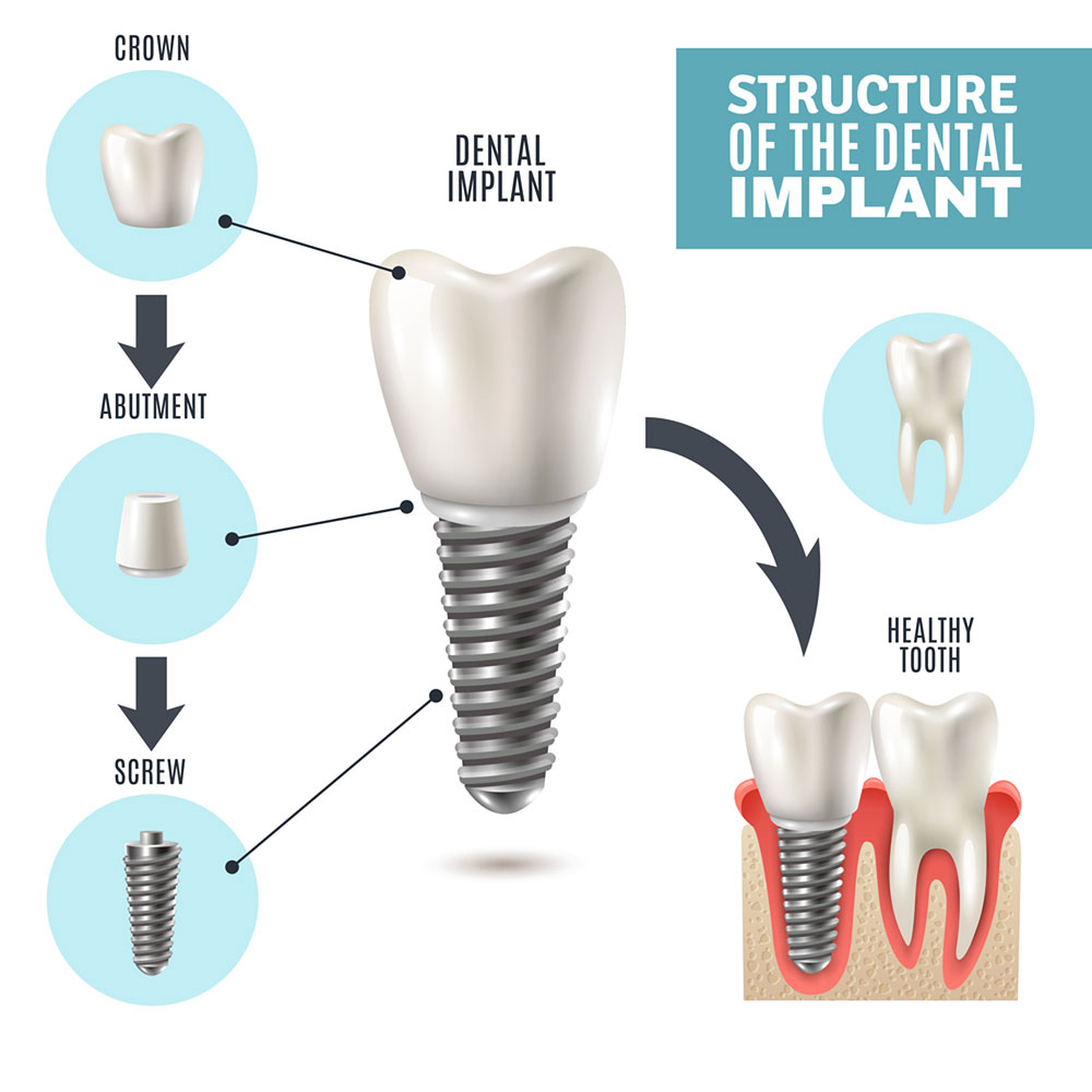 dentist in Jaipur