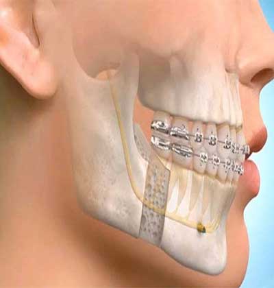 oral and maxillofacial surgery