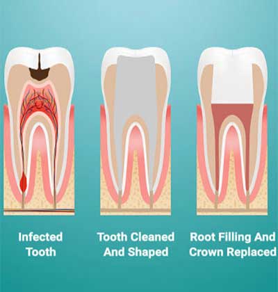 dentist in Jaipur